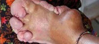 پسری برای قطع پاهایش به پزشکان التماس می کند! (عکس)