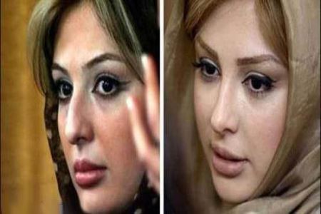 عکس های بازیگران زن ایرانی قبل و بعد از جراحی زیبایی