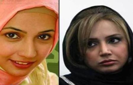 عکس های بازیگران زن ایرانی قبل و بعد از جراحی زیبایی