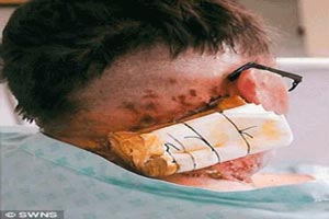 اسید پاشی هولناک به داور معروف + عکس