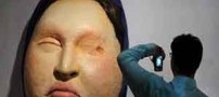 تکرار فاجعه اسید پاشی در تهران