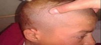 ظاهر عجیب پسری با گلوله فشنگ در سرش (عکس)