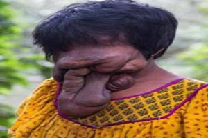 صورت عجیب دختری بدون چهره ! 16 + عکس