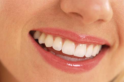 دندان های تمیز و زیبا با رعایت این نکات