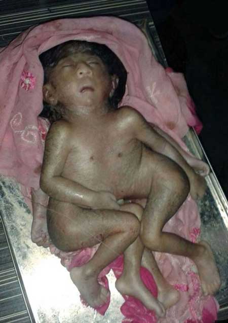خدای جدید هندی ها این نوزادِ انسان چهارپاست (عکس)