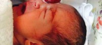 نوزادی با چشم بیرون از حدقه در اصفهان متولد شد (عکس18+)