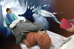 دختر تهرانی بخاطر ازدواج اجباری به خودش اسید پاشید