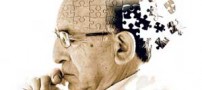 9 نکته خیلی مهم درمورد بیماری آلزایمر
