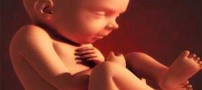 عکسهای خارق العاده از رقص جنین در شکم مادر