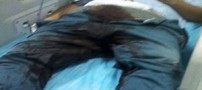 دختری که با اسید دستگاه تناسلی نامزدش را نابود کرد (عکس18+)