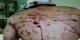کنده شدن نصف پای این مرد ایرانی در اثر حمله گرگ (عکس18+)