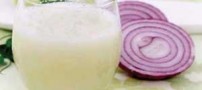 کم هزینه ترین روش برای کاهش ریزش مو