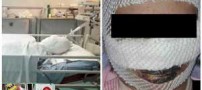 فاجعه هولناک سوختن یک مادر در اتاق زایمان (عکس)