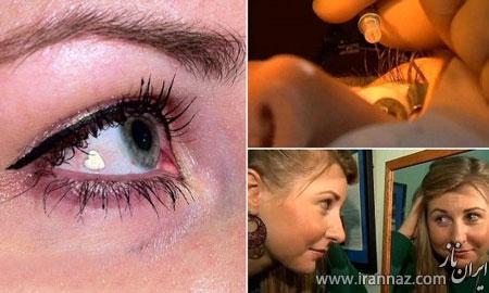 جراحی زیبایی دختری با کاشت نگین در چشم (عکس) جراحی زیبایی دختری با کاشت نگین در چشم (عکس)