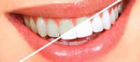 راه کارهای خانگی برای سفید کردن دندان ها
