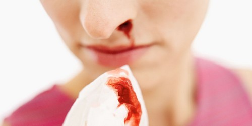 آیا خون دماغ شدن بی دلیل خطرناک می باشد؟