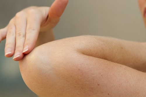 علت سیاه شدن آرنج و سر زانو چیست؟ علت سیاه شدن آرنج و سر زانو چیست؟