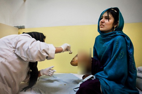 تصاویر دردناک از زخم‌هایی بر تن زنان افغان