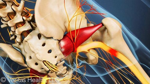 چگونه سیاتیک را با داروهای طبیعی درمان کنیم؟ چگونه سیاتیک را با داروهای طبیعی درمان کنیم؟