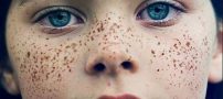 راهی برای از بین بردن کک و مک پوست