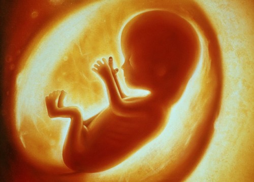 سقط جنین با مواد غذایی ارتباط دارد؟