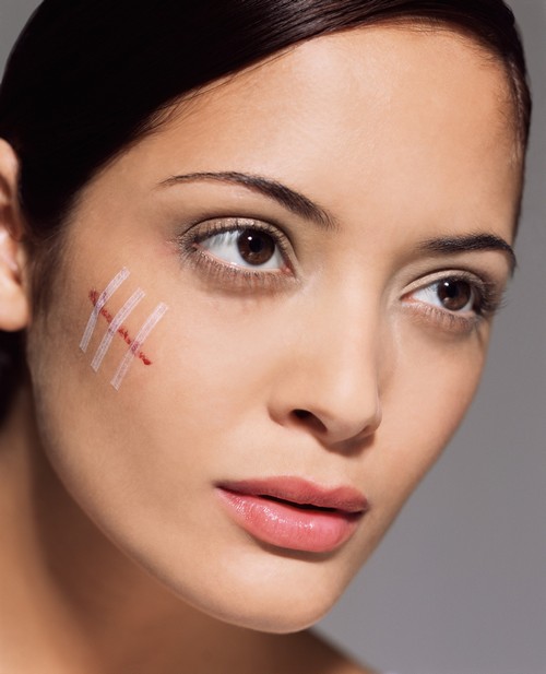 چگونه جای زخم روی صورت را از بین ببریم؟! چگونه جای زخم روی صورت را از بین ببریم؟!