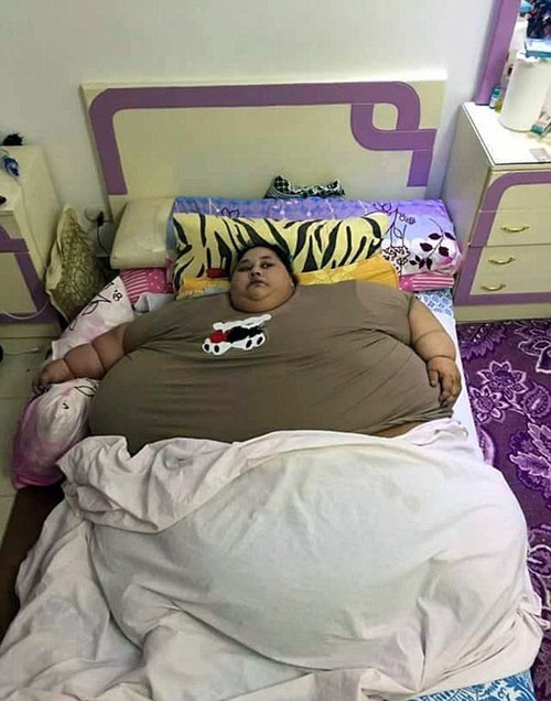 این زن با وزن 500 کیلوگرم چاق ترین زن دنیا است (عکس)