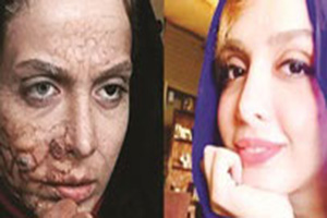 عکسی که به نام مهناز افشار جا زدند +تصویر