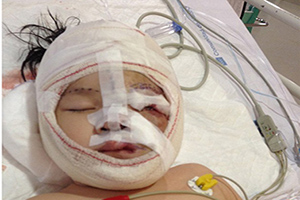 دختر زیبایی که نیمی از صورتش میخندد +تصاویر 16+