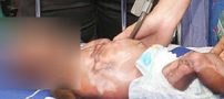 مادر شیرازی نوزاد شیرخوارش را با نفت آتش زد