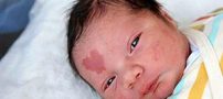 نوزاد که با علامت عشق روی صورتش بدنیا آمد +عکس