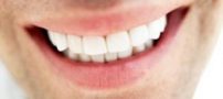 چهار روش خانگی برای سفید کردن دندان