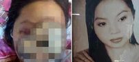 صورت خانم بازیگر بخاطر نیش حشره متلاشی شد (عکس 18+)