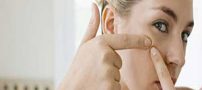 بهترین ماسکهای از بین برنده جوش سر سیاه