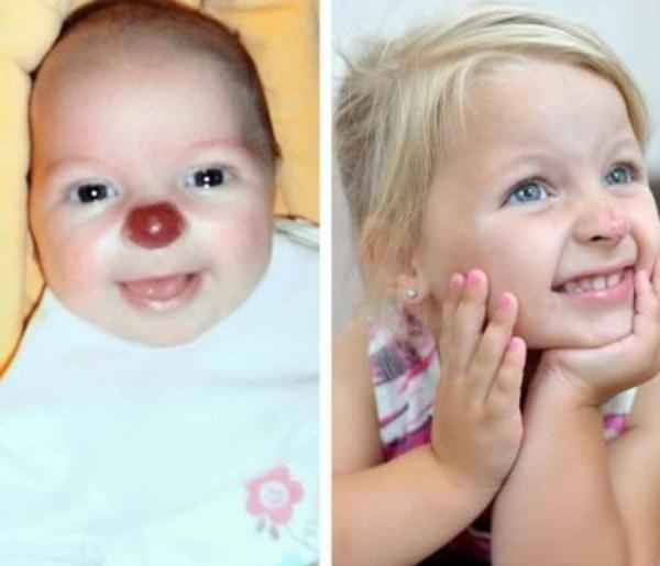 بیماریهای بسیار عجیب مادرزاردی (عکس) بیماریهای بسیار عجیب مادرزاردی (عکس)