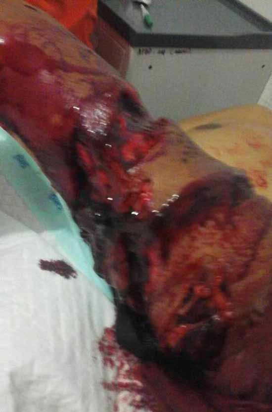 درگیری این مرد با مار کشنده و ترسناک (18+ عکس)