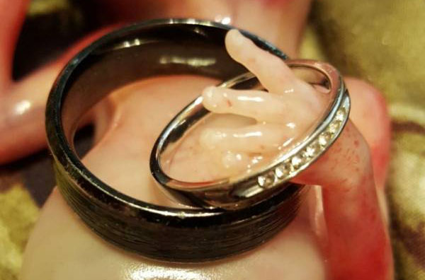 ماجرای دردناک سقط جنین 14 هفته ای (عکس18+)