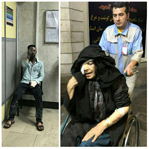 عکس های دلخراش مصدومین چهارشنبه سوری 96 عکس های دلخراش مصدومین چهارشنبه سوری 96