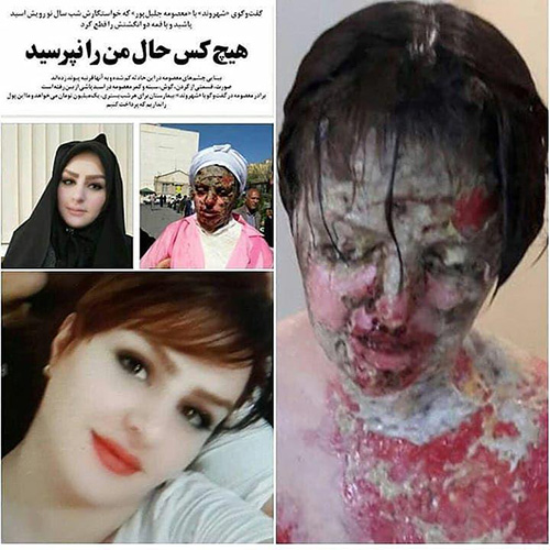 درخواست کمک پرویز پرستویی برای دختر تبریزی (عکس) درخواست کمک پرویز پرستویی برای دختر تبریزی (عکس)