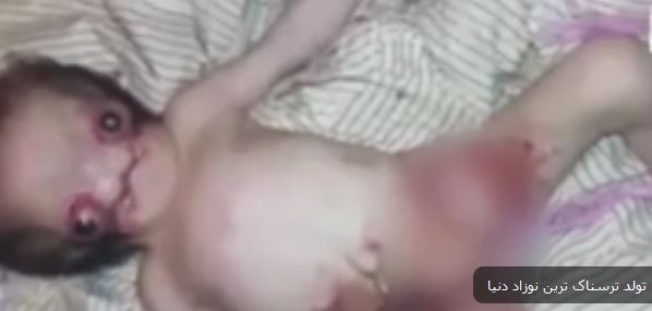 ترسناک ترین نوزاد عجیب الخلقه جهان متولد شد 18+ (عکس) ترسناک ترین نوزاد عجیب الخلقه جهان متولد شد 18+ (عکس)