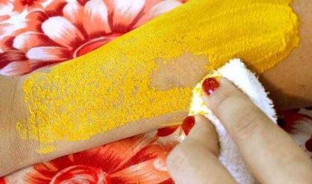 بهترین روش برای رفع موهای زائد بهترین روش برای رفع موهای زائد