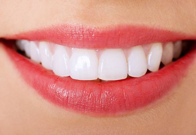 لبخند زیبا و جذاب اما راه آن چیست؟ لبخند زیبا و جذاب اما راه آن چیست؟