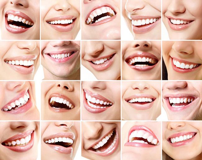 لبخند زیبا و جذاب اما راه آن چیست؟ لبخند زیبا و جذاب اما راه آن چیست؟