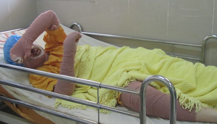 دختر خودسوز با لقب «دختر آبی» درگذشت دختر خودسوز با لقب «دختر آبی» درگذشت