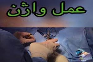 جوانسازی آلت تناسلی با تزریق چربی به واژن