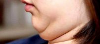 در ده دقیقه از شر غبغب خلاص شو !