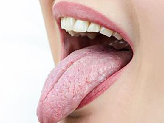 کووید زبان چیست و چه علائمی دارد؟ کووید زبان چیست و چه علائمی دارد؟