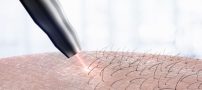 6 دلیل اساسی برای اینکه از حذف موهای زائدتان منصرف شوید