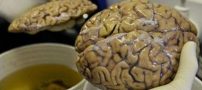 بانکی که در هاروارد از مغز انسان نگهداری میکند + عکس