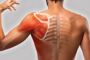 همه چیز درباره تاندونیت + دلایل و علائم و راه های درمان